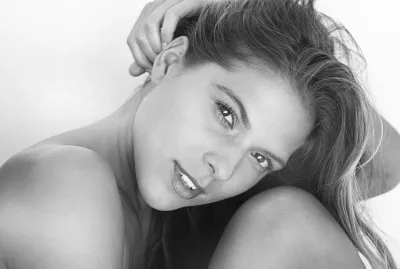 Buccal fat removal, Wangenfett-entfernung