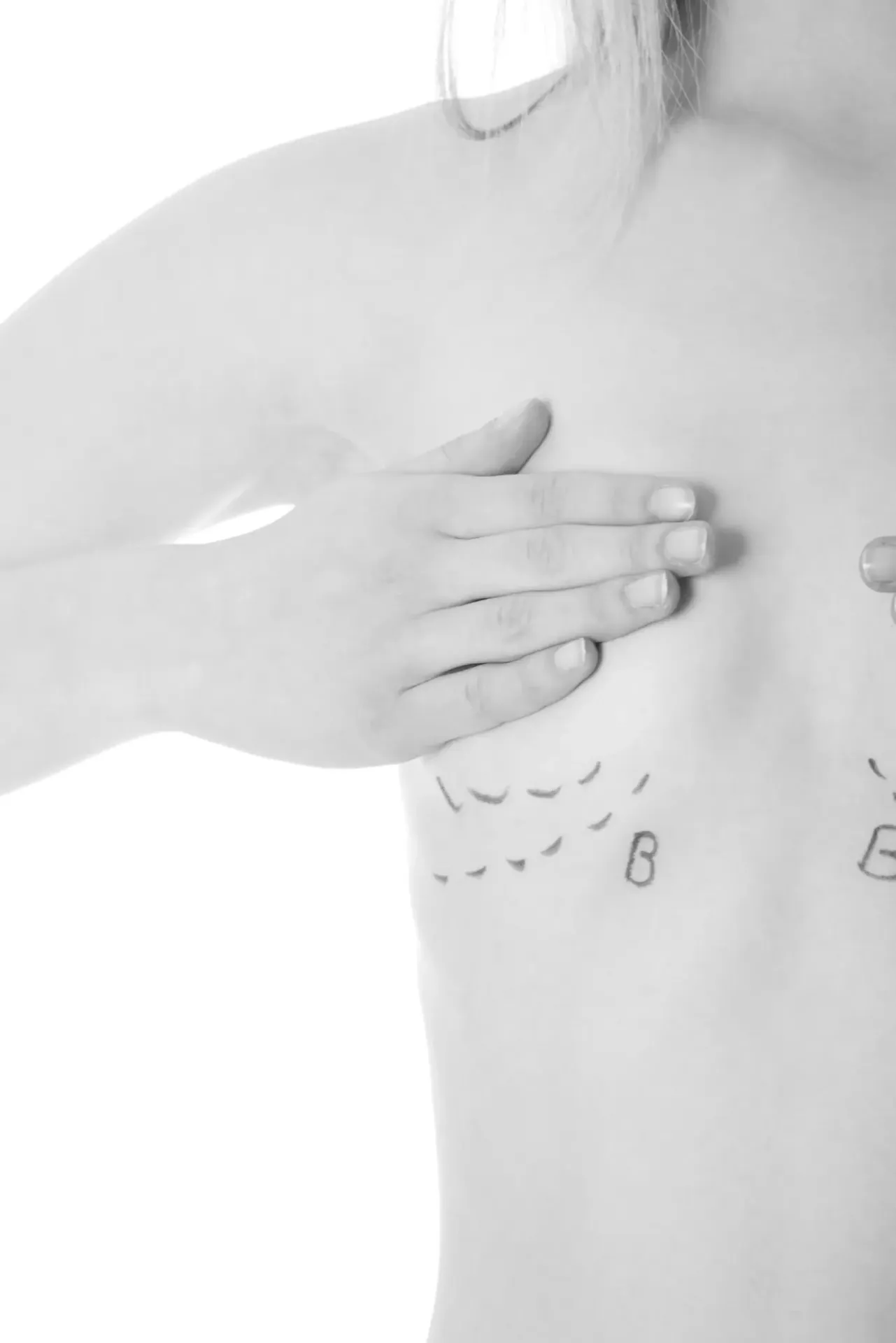 Scars after a breast augmentation and how to care for them
