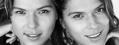 Upper and lower eyelid lift