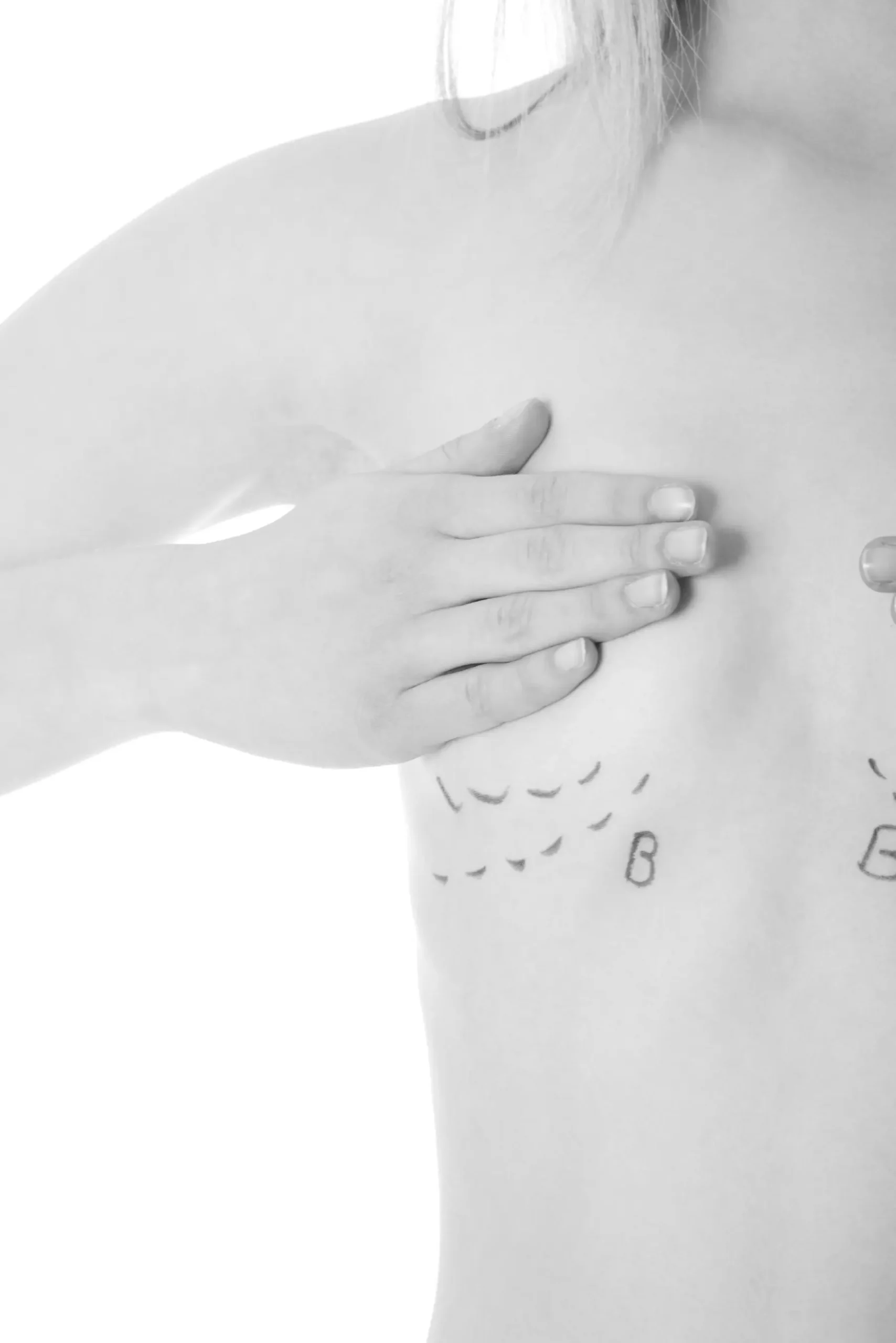 Narben nach einer Brustvergrößerung und dessen Pflege